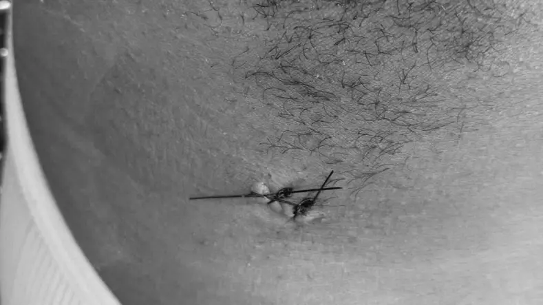 whatsapp image 2025 08 06 at 172752 1 5467b0ba focus 0 0 789 443