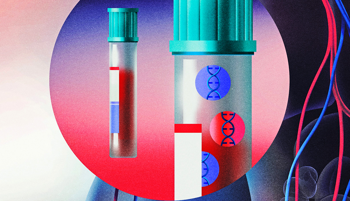 1140 blood test esp