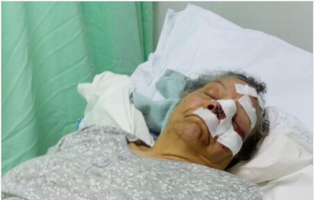 Abuela sufrió heridas graves en el rostro